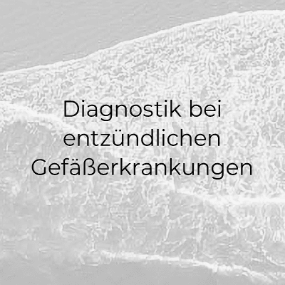 Diagnostik bei Gefäßerkrankungen im Herzzentrum Kiel, spezialisiert auf Herz- und Gefäßgesundheit.