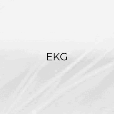 EKG Gerät im Herzzentrum Kiel, Herzgesundheit und Kardiologie.